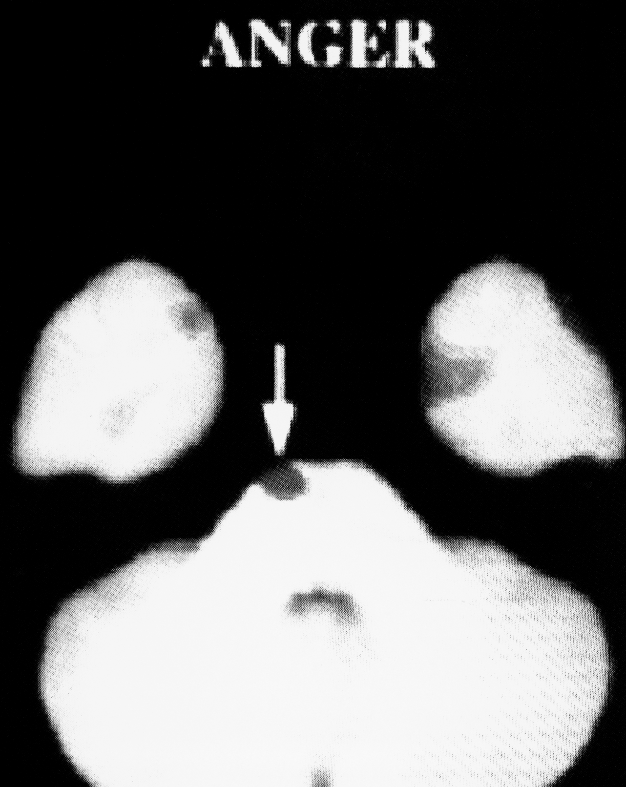 Laia Abril, ANGER, Mind Series (Case 2, Cambodia, On Mass Hysteria), (2023). © Courtesy of galerie Les filles du calvaire, Paris.